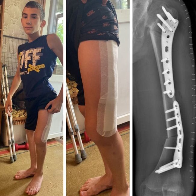 Maksym is fighting for his life — let’s help together