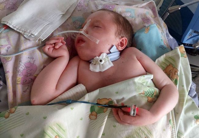 Oxygen Concentrator Purchased: Oleh’s Continued Life at Home