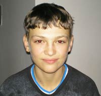 Save a child: Lutsenko Dima, 13 years old - relapse of accute limphoblastic leucaemia