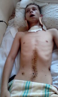 Aleksandr Boronin, 19 years old – Polytrauma after a Road Traffic Accident