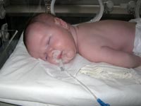 Kosheva Natasha, born in 2011 – Fetal infection, lungs affection