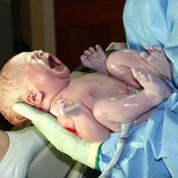 В Запорожье новорожденным нужны кювезы и аппараты искусственной вентиляции легких